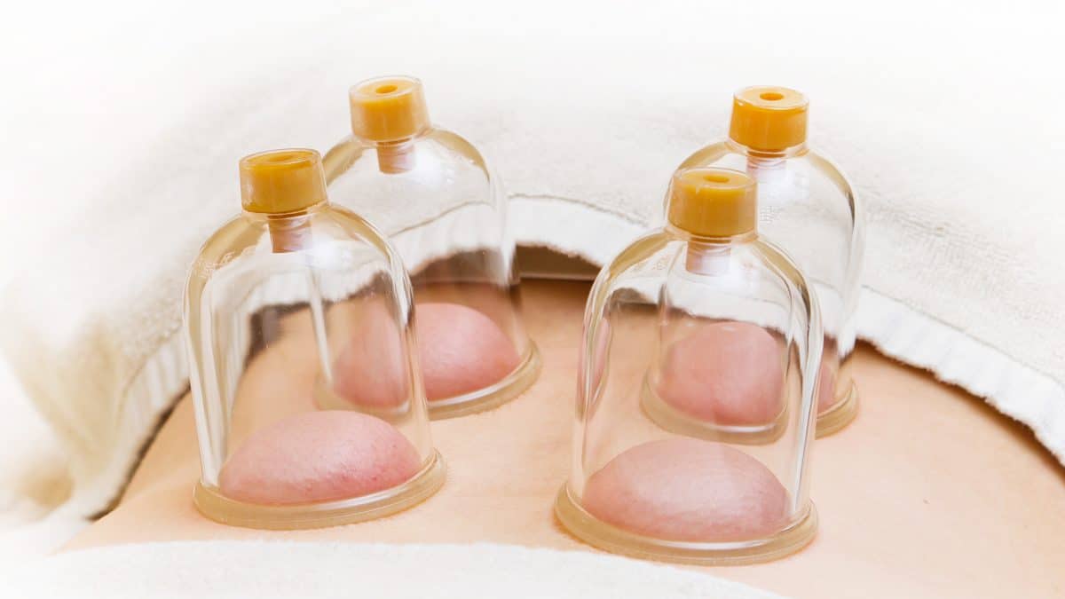 Massage Suction Cupping Therapy Brisbane – New Medication for Pain